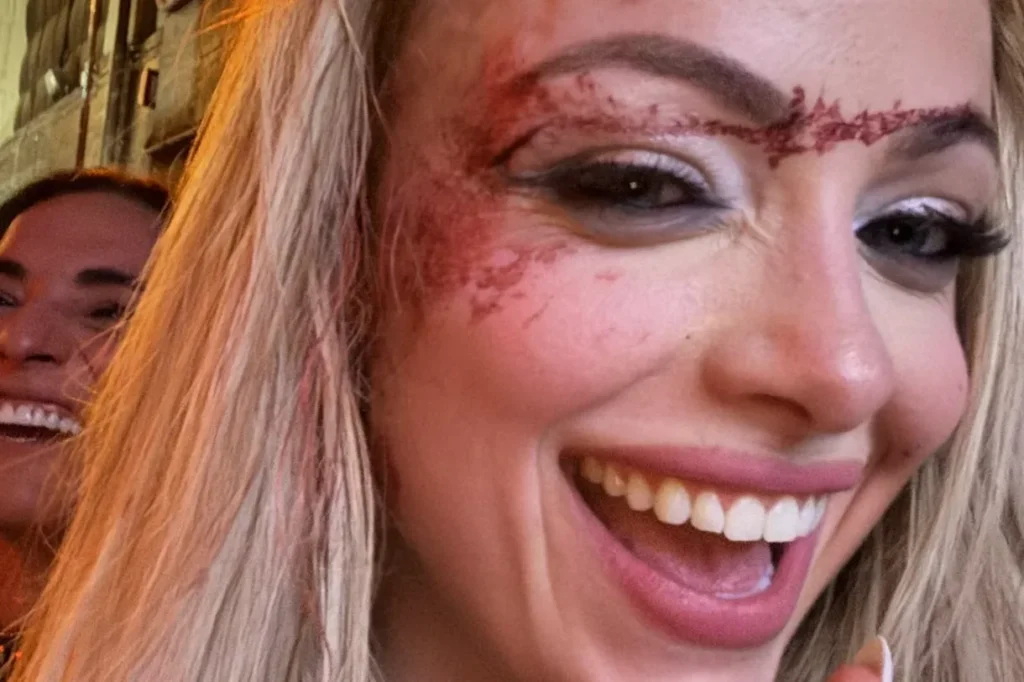 Liv Morgan Smiles Through the Pain After Suffering Nasty Cut on WWE Raw